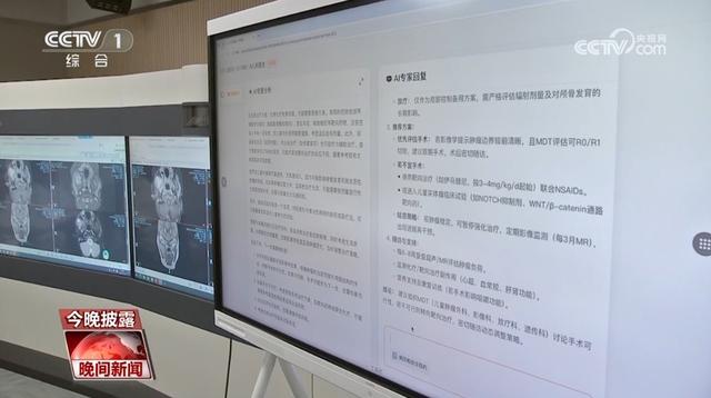 “AI+医疗”已成为热门应用领域 “AI医生”你能接受吗？
